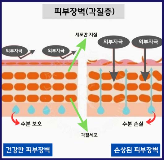 피부 속건조 방지를 위한 피부장벽