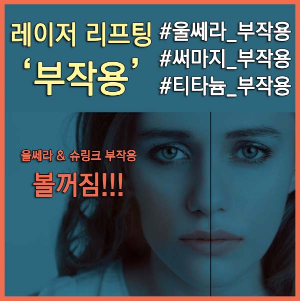 레이저 리프팅 부작용 썸네일