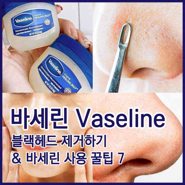 바세린 블랙헤드 제거 vaseline