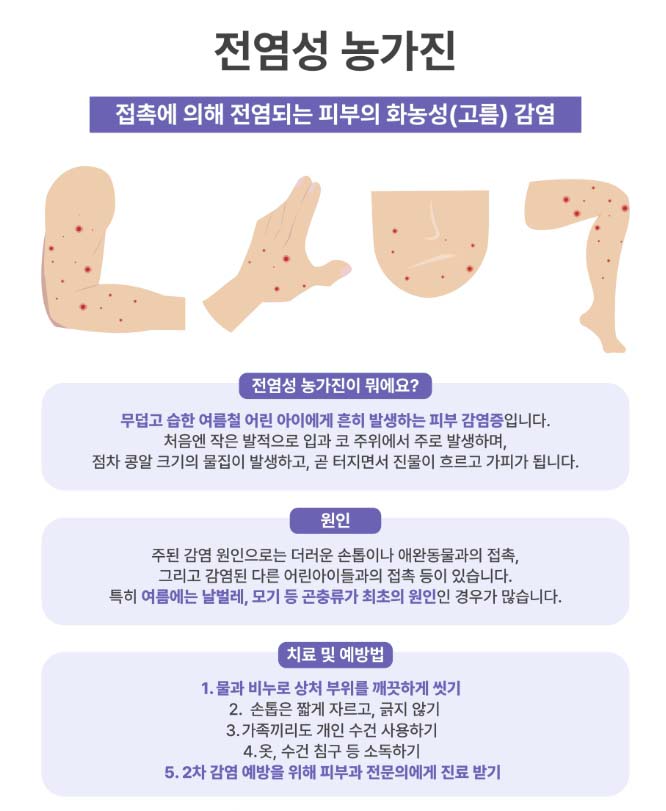 전염성 농가진