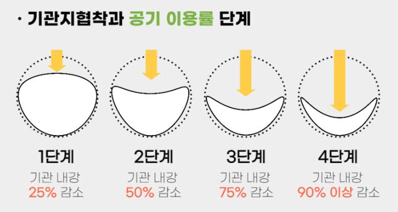 강아지 기관지협착증 단계