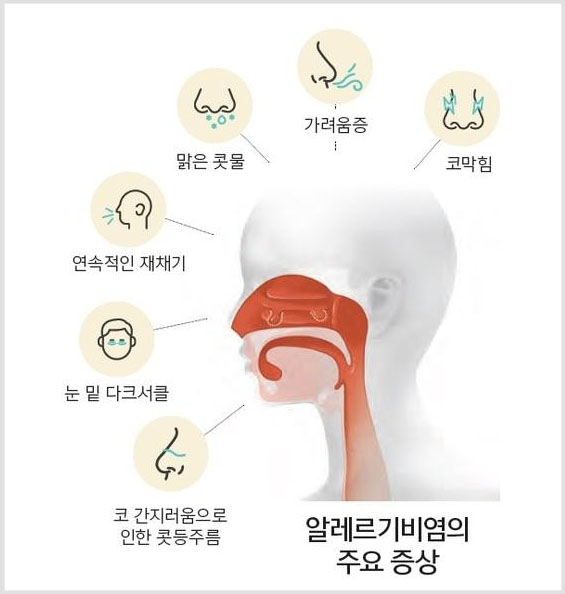 알레르기 비염의 주요 증상