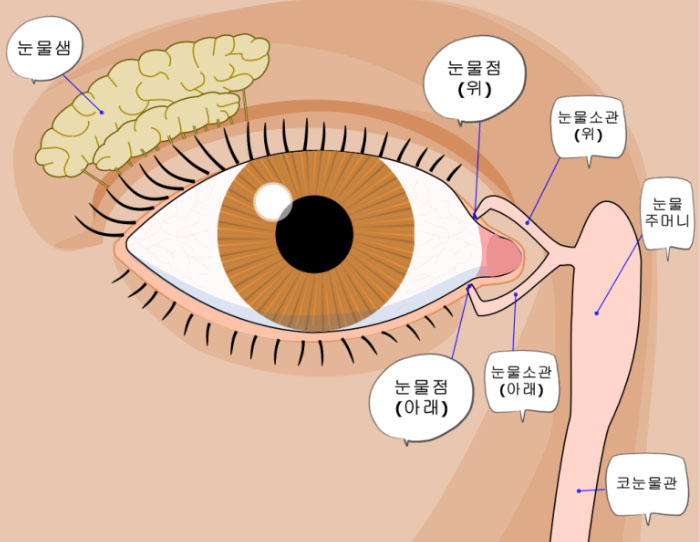 누점 마개