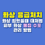 화상 응급처치