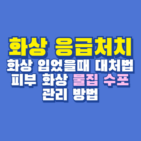 화상 응급처치