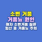 소변 거품