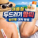 여름철 두드러기 땀띠