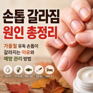 손톱 갈라짐